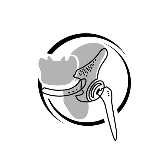 Master of Bone Augmentation